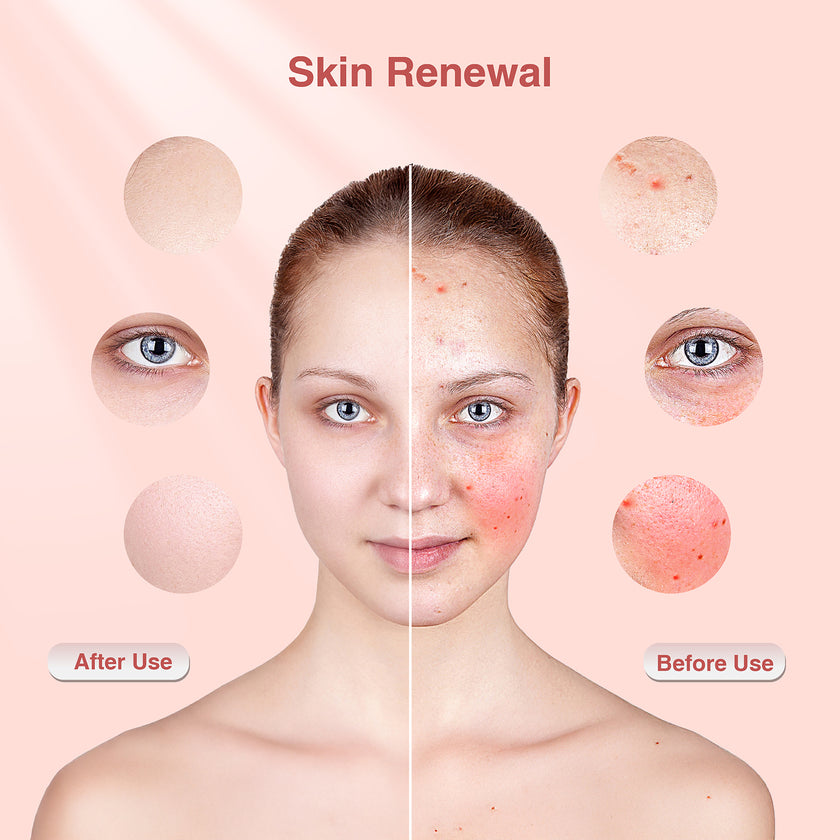 LED Light Therapy Face Mask